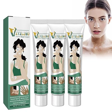 White Spot Cream Vitiligo Cream Vitiligo Cream Vitiligo Cream for White Spots Vitiligo Skin Care Balm Vitiligo Cream Repigmentation Cream for White Skin Spots and Vitiligo